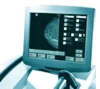    KODAK DirectView CR mammography feature