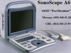 SonoScape A6 -  -    