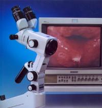   COLPOSCOPE 150FC