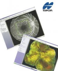     Topcon IMAGEnet Professional