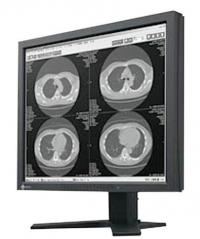   EIZO RadiForce G11