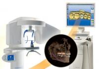    CEREC  GALILEOS